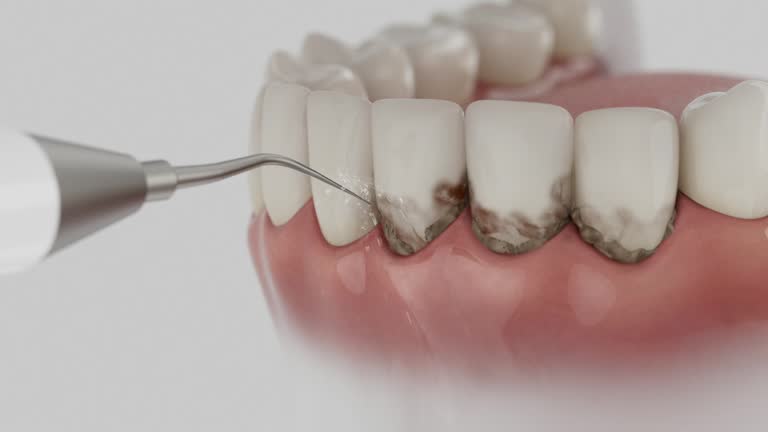 Reliable Teeth Cleaning And Checkup contractor in Haskell County County, KS by Dentist Open Now